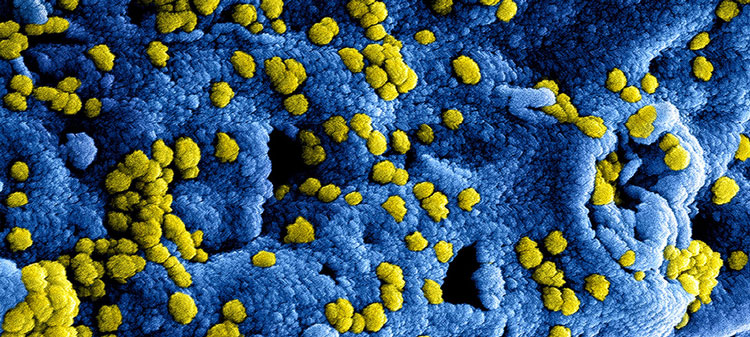 Noticia de Almera 24h: China confirma 41 casos de un nuevo coronavirus que ya se ha cobrado una vctima